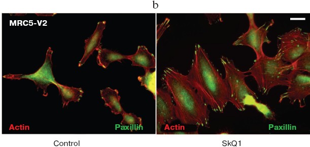 Figure 11b