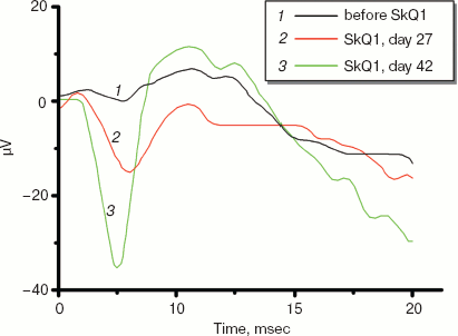 Figure 11